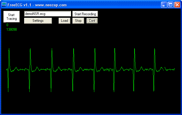 Free ECG Project