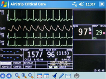 AirStrip OBSERVER Suite