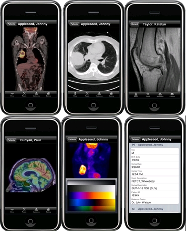 MIM iPhone Application