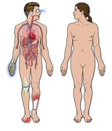 Preoperative Patient Education
