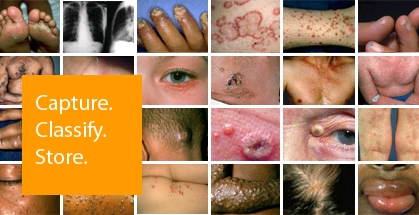 Visual clinical decision support