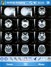 AirStrip OBSERVER Suite