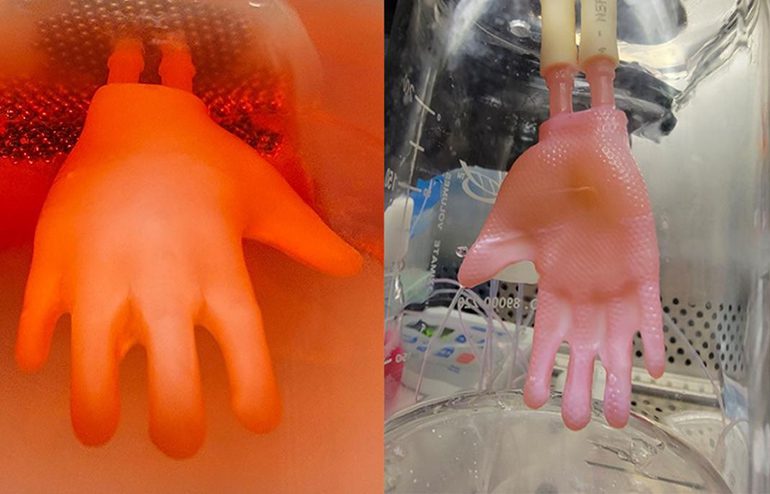 3D Bioengineered Skin Grafts Fit Complex Anatomy