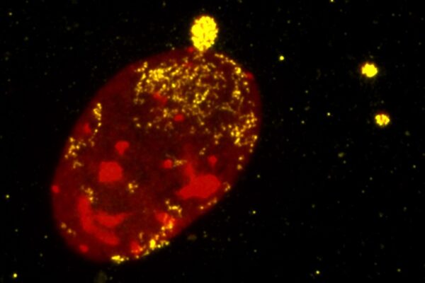 Adverse Survival Signal Leads G1 to Stop Pivotal Test in Colorectal Cancer