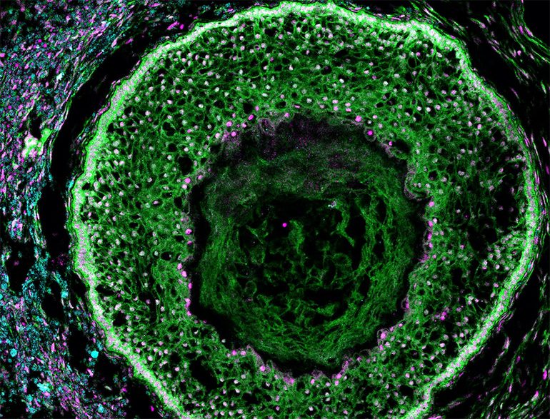 Ovarian Organoids to Study Reproductive Health