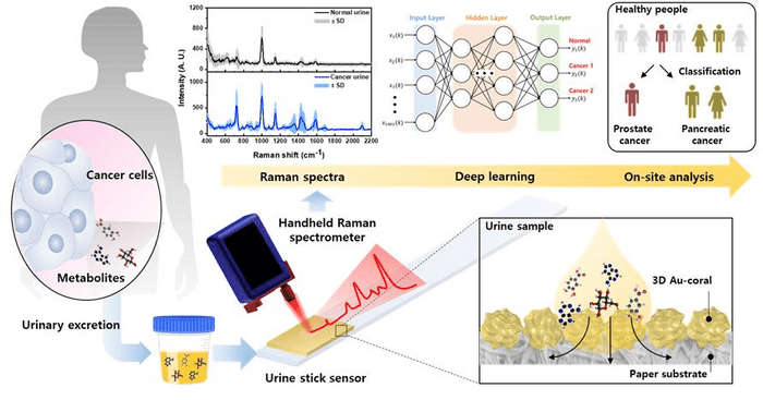 Raman-Based Urine Sensor Detects Cancer Metabolites