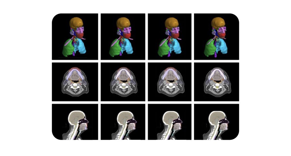 Google announces more AI partnerships and other health updates