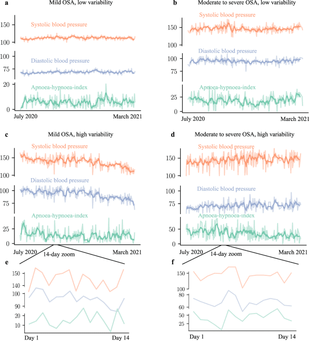 High night-to-night variability in sleep apnea severity is associated with uncontrolled hypertension