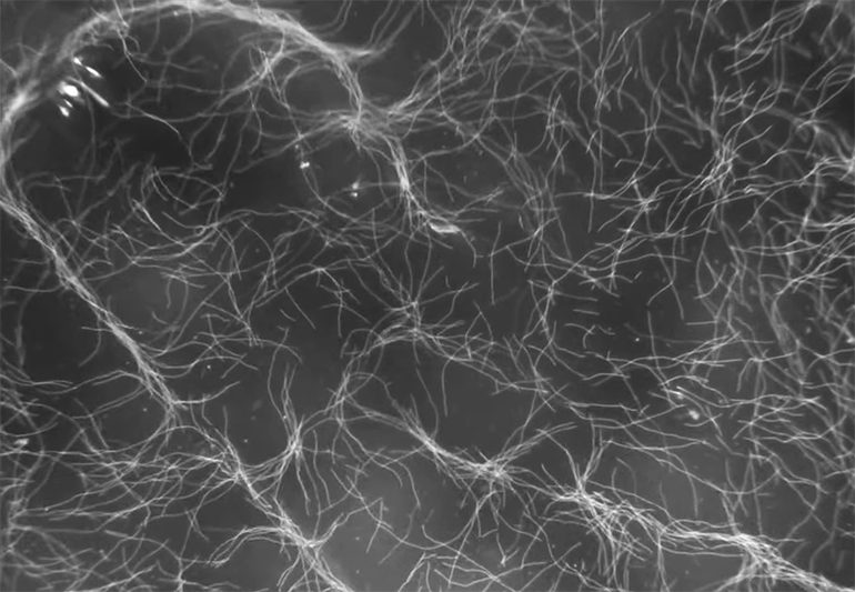 Moving Cells Using Ultrasound