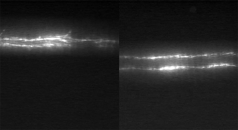 Nanoparticles Get Lymphatic Vessels Pumping