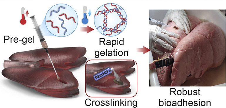 Gelatin-Based Surgical Sealant for Rapid Sealing Inside the Body