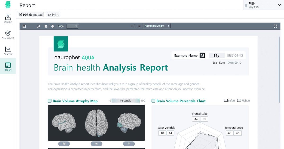 Singapore approves Neurophet's AI brain degeneration analysis software