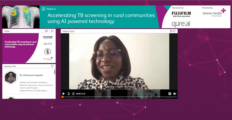 Webinar: Accelerating TB screening in rural communities using AI powered technology