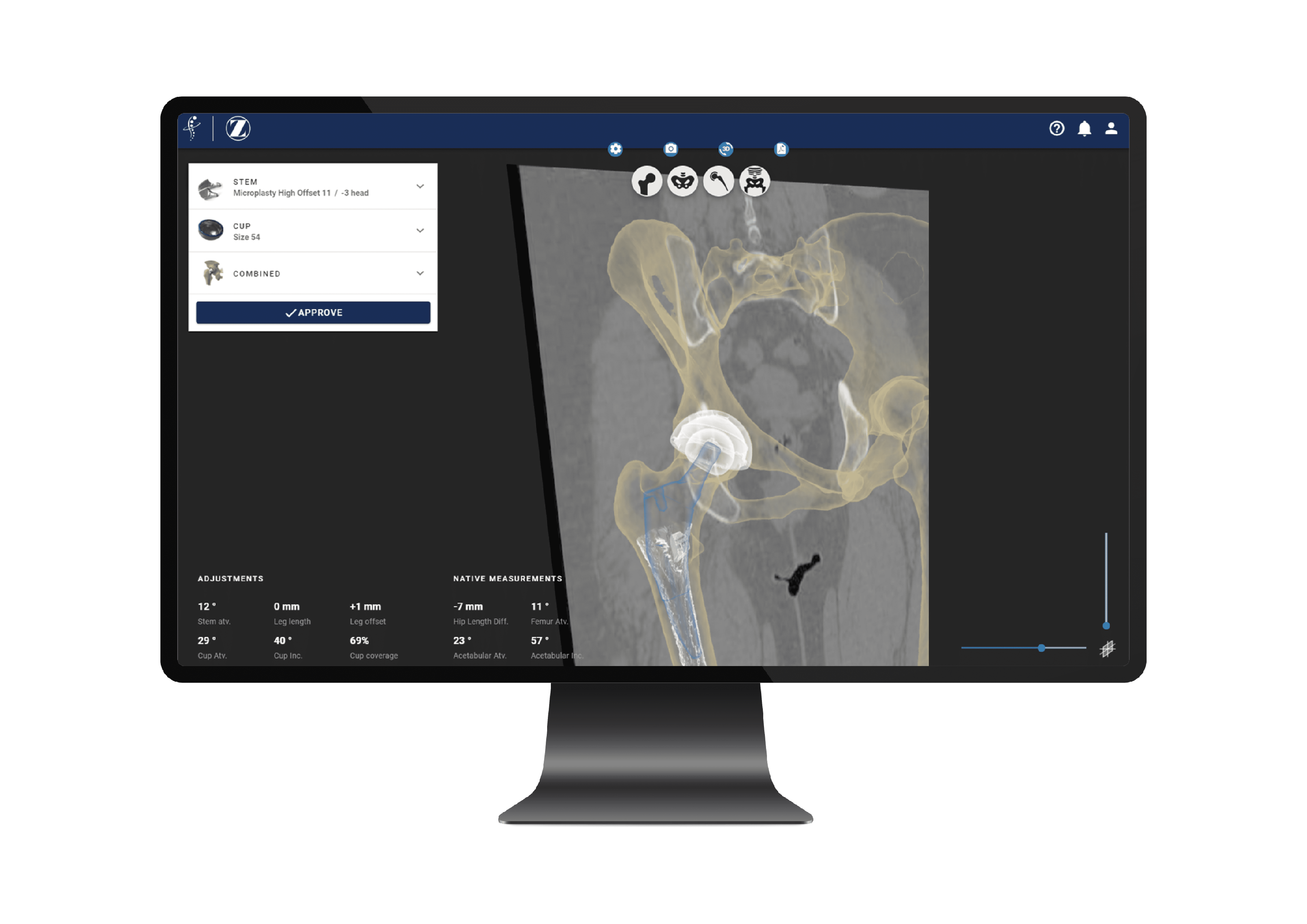 Formus Labs’ Hip Surgery Planning Software Expands into the US with FDA Clearance