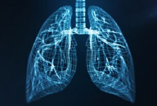 Machine Learning Helps Identify Pneumonia as Driver of COVID-19 Deaths