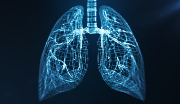 Machine Learning Helps Identify Pneumonia as Driver of COVID-19 Deaths