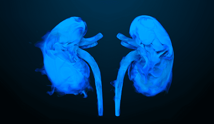 Predictive Analytics Model Forecasts Diabetic Kidney Disease