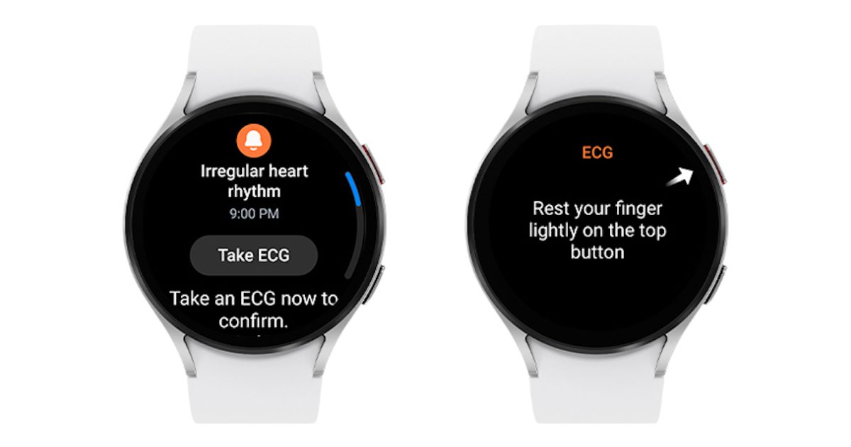 Samsung Galaxy Watch receives FDA clearance for AFib monitoring