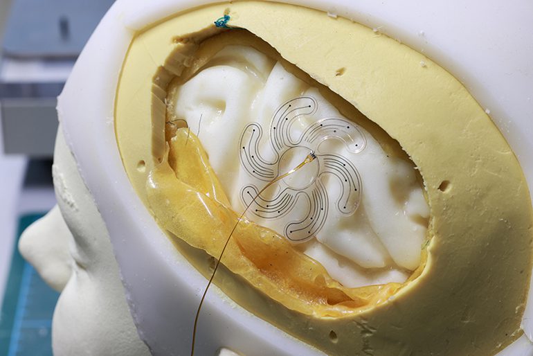 Soft Robotic Electrode Enables Minimally Invasive Placement |