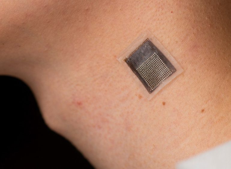 Wearable Ultrasound Measures Tissue Stiffness Under Skin |