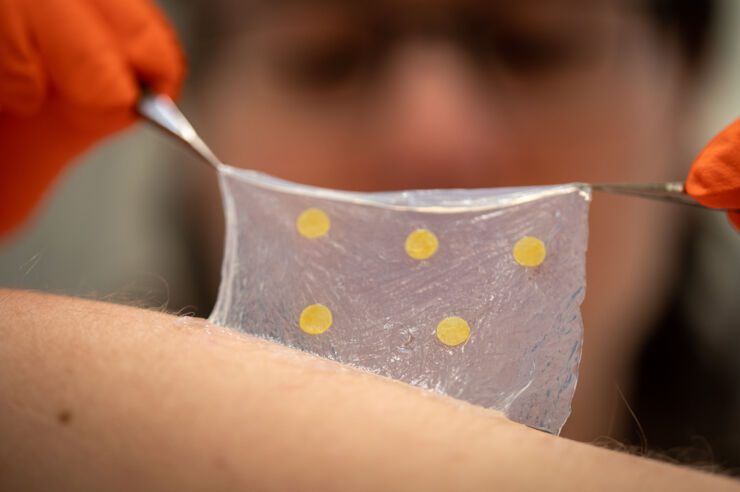 Wound Dressing Detects Infection, Changes Color