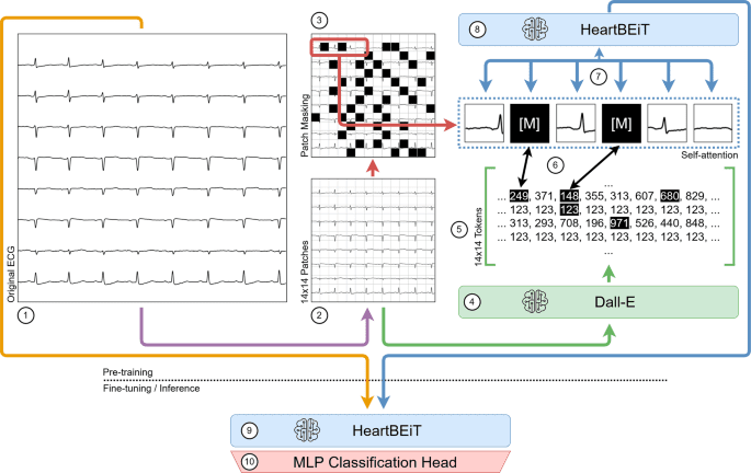 A foundational vision transformer improves diagnostic performance for electrocardiograms