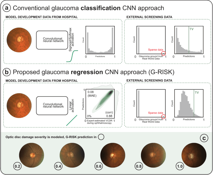 A generalizable deep learning regression model for automated glaucoma screening from fundus images