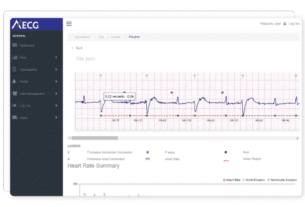 AccurKardia Secures $2.7M for Clinical Grade ECG Analytics