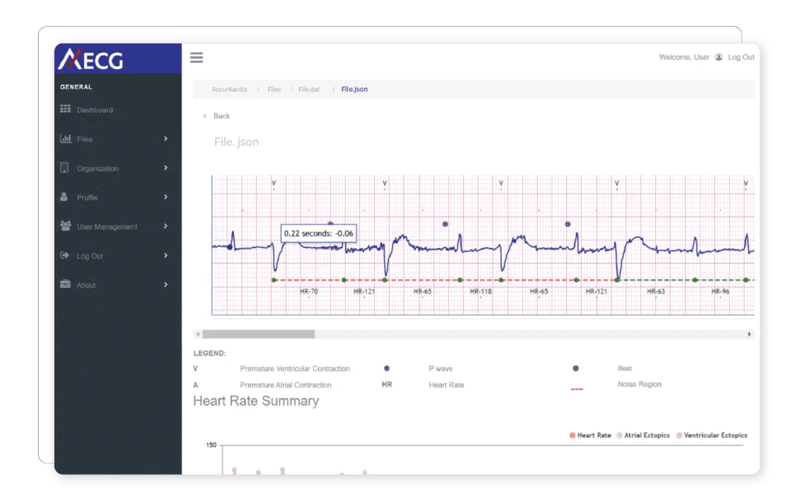 AccurKardia Secures $2.7M for Clinical Grade ECG Analytics