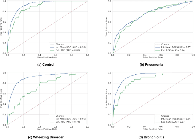DeepBreath—automated detection of respiratory pathology from lung auscultation in 572 pediatric outpatients across 5 countries