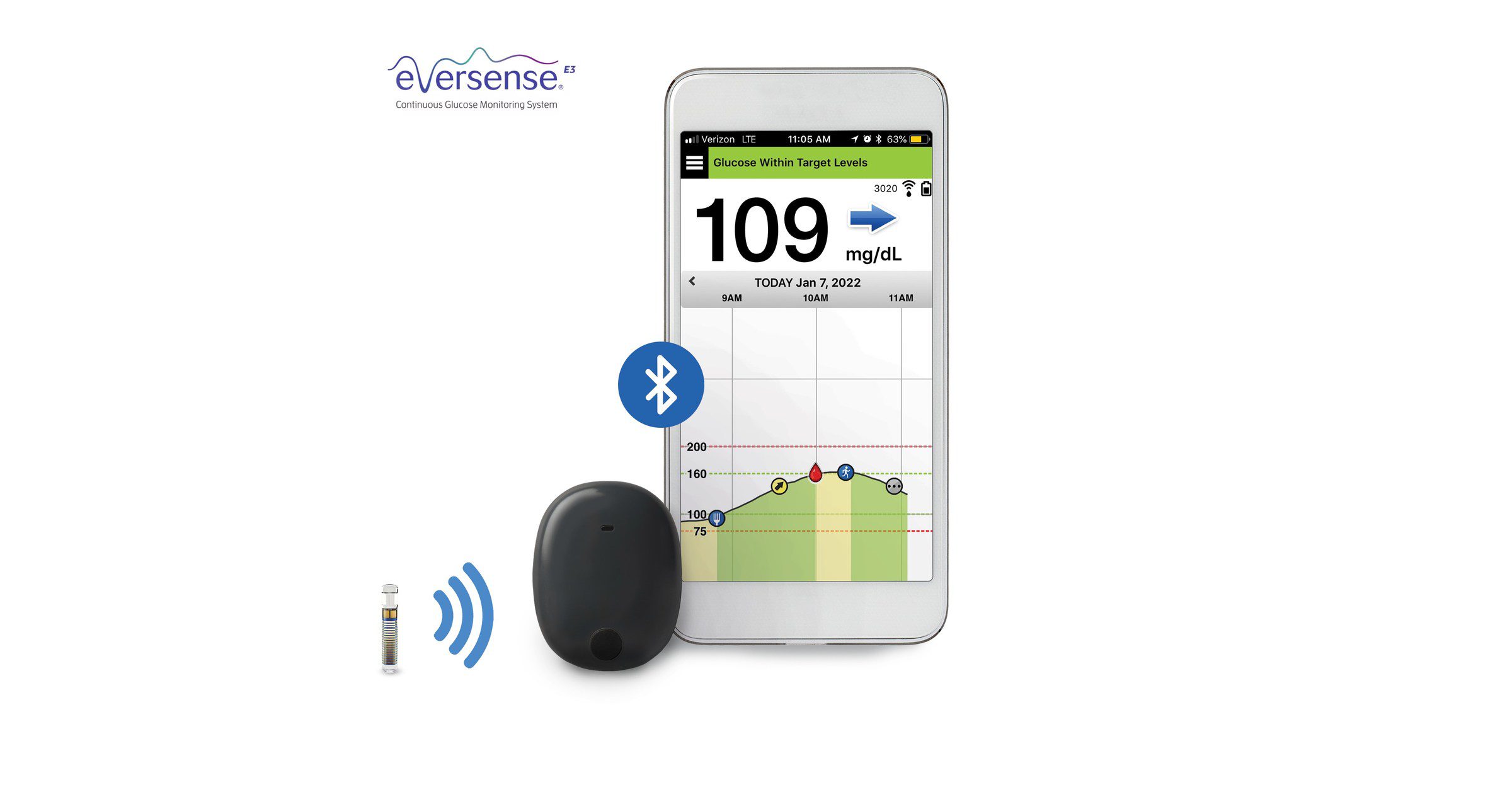 Eversense E3 CGM for Diabetes Now Covered by UnitedHealthcare