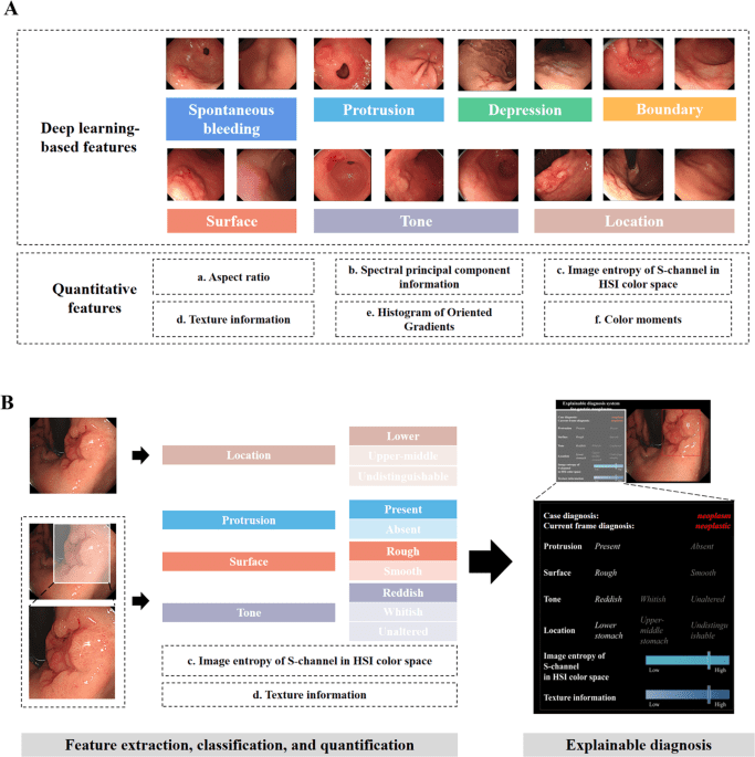 Publisher Correction: Explainable artificial intelligence incorporated with domain knowledge diagnosing early gastric neoplasms under white light endoscopy