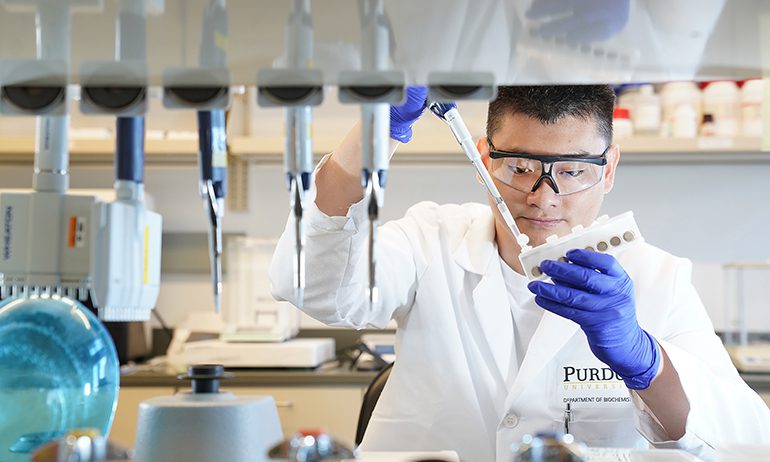 Urine Test for Parkinson’s Disease |