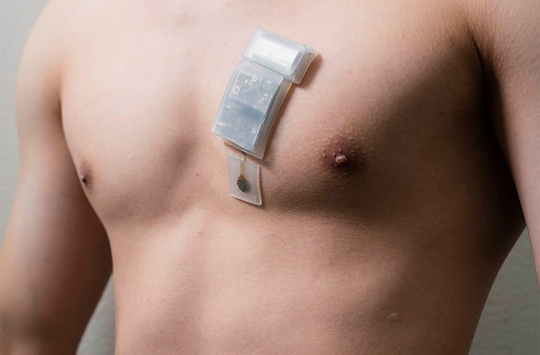 Wearable Ultrasound for Deep Tissue Monitoring |