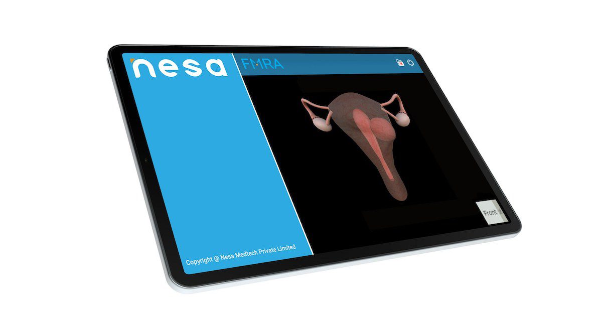 Roundup: Nesa gets US FDA 510(k) for fibroid mapping tool and more briefs