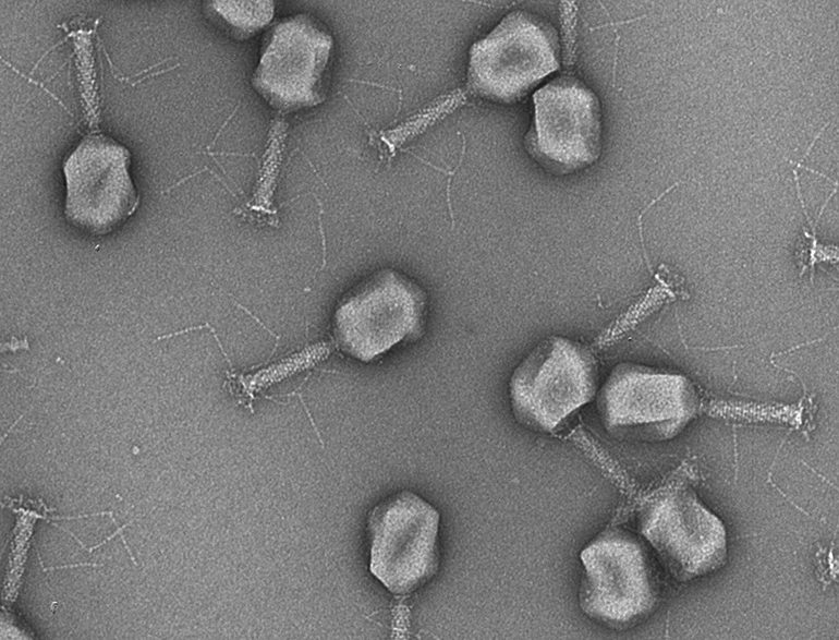 Bacteriophages to Diagnose and Treat Bladder Infections |