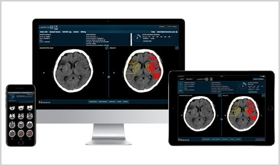 Brainomix Improves Access to Stroke Treatment across NHS – AHSN