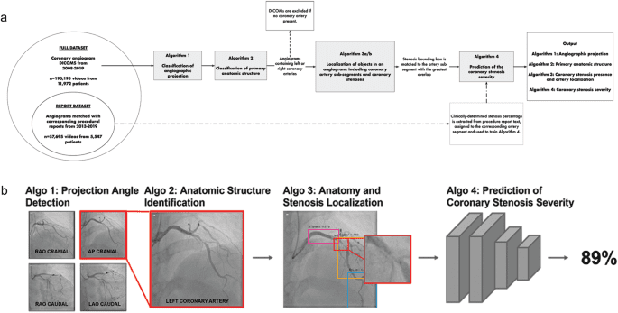 CathAI: fully automated coronary angiography interpretation and stenosis estimation