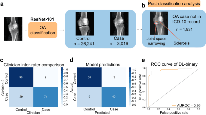 Deep learning based phenotyping of medical images improves power for gene discovery of complex disease