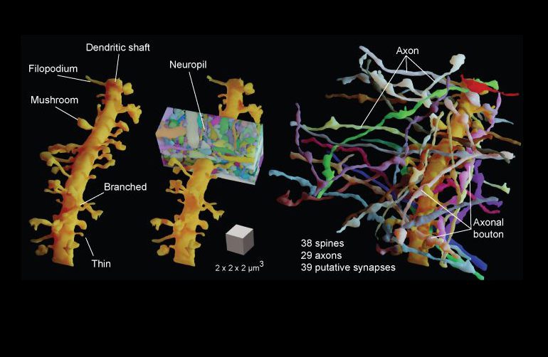 Imaging Technique Reveals Living Brain Tissue in its Complexity |
