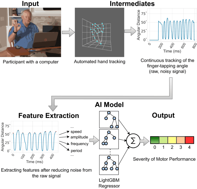 Using AI to measure Parkinson’s disease severity at home