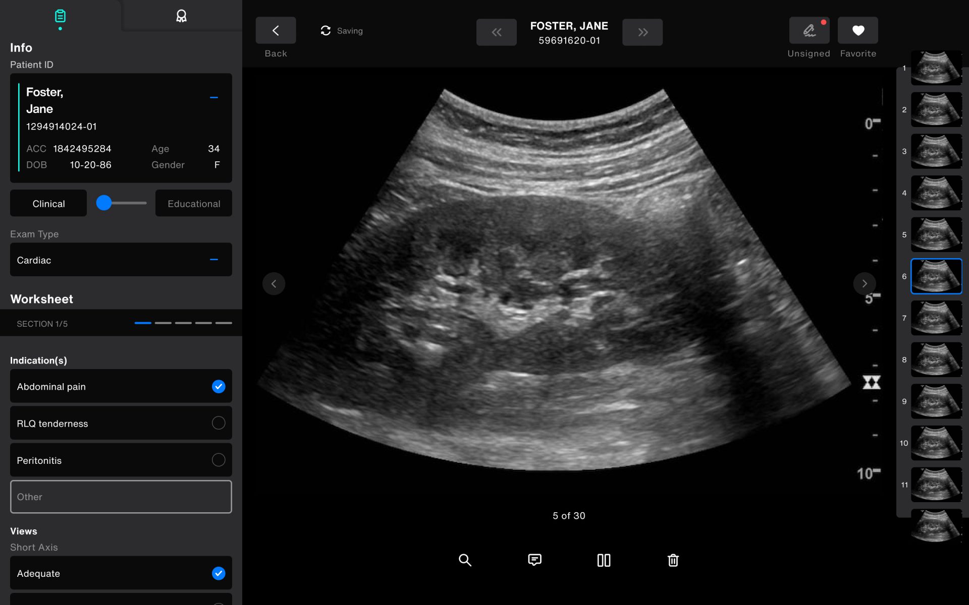 Addressing Point-of-Care Ultrasound’s Shadow IT Problem