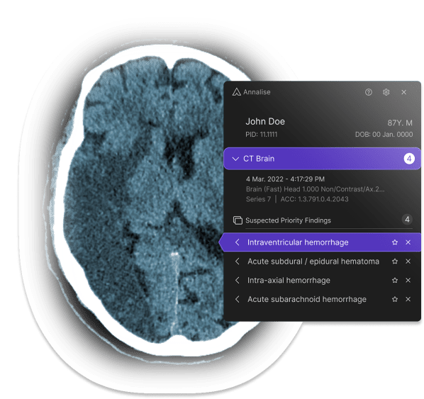 Annalise.ai Receives FDA Clearance for Radiology Triage Device