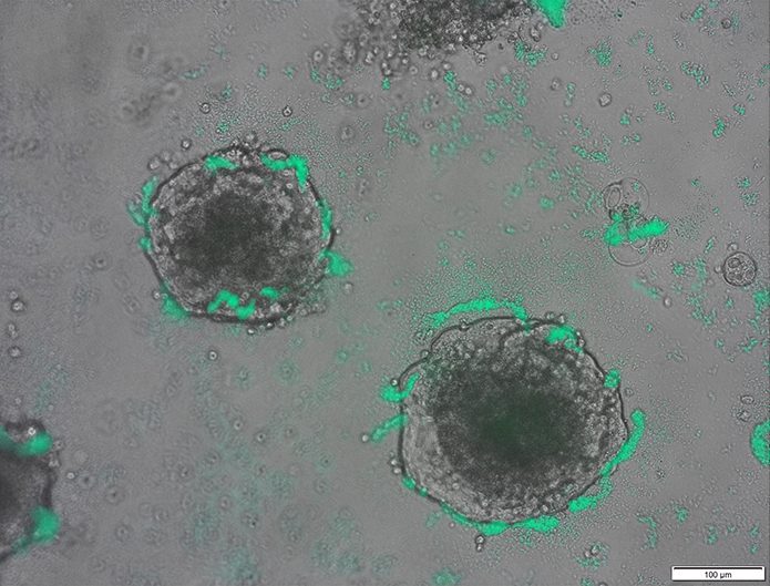 CRISPR-Equipped Bacteria Detect Tumors |