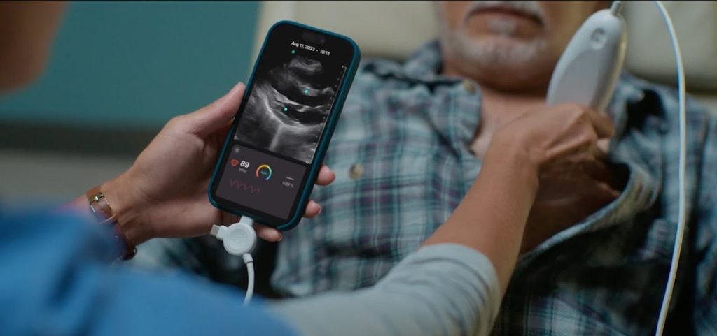 Exo Introduces Exo Iris, a Revolutionary Ultrasound for Healthcare