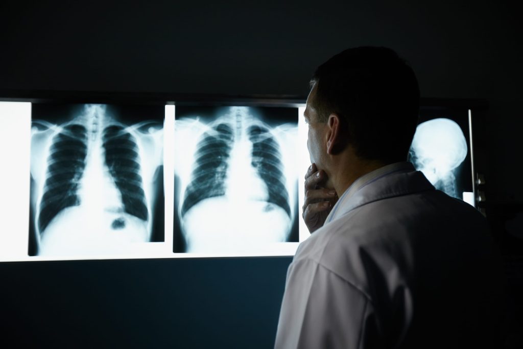 Qure.ai’s AI-Powered X-Ray Solution Gets FDA Nod for Critical Diagnoses