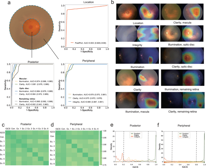 DeepQuality improves infant retinopathy screening