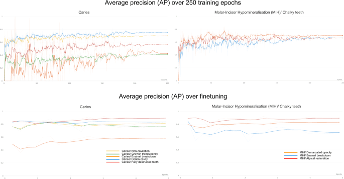 Detection and localization of caries and hypomineralization on dental photographs with a vision transformer model