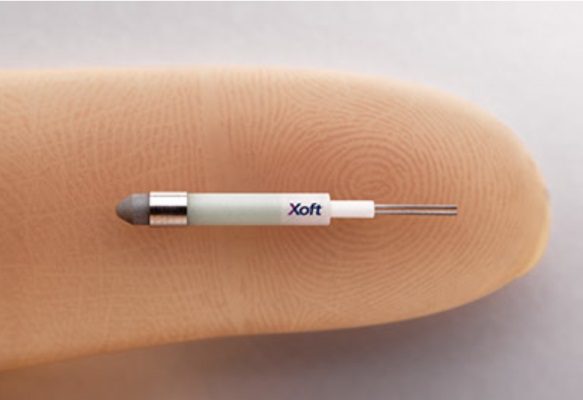 Elekta Broadens Cancer Treatment Offerings with Xoft Acquisition