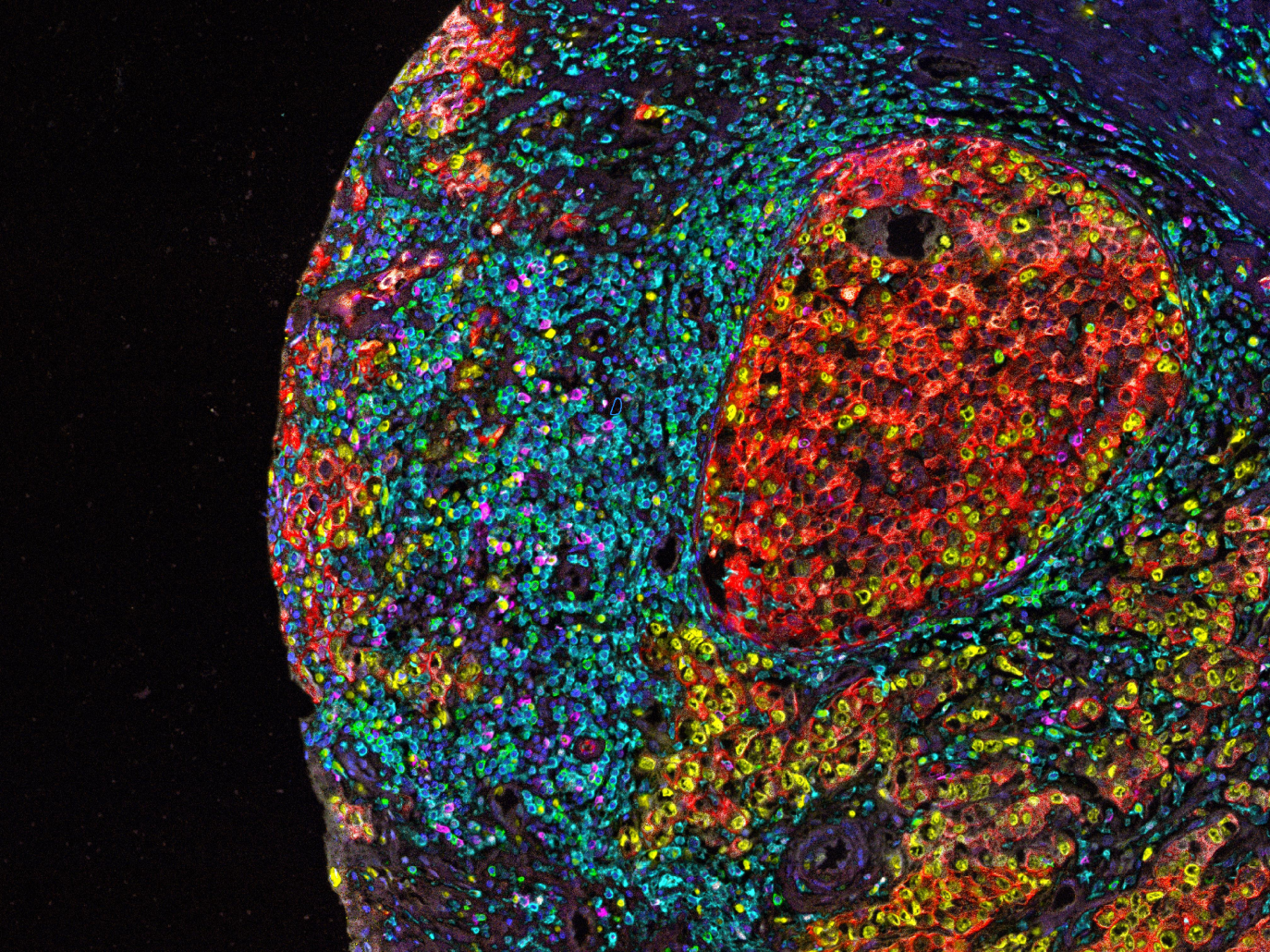 Georgiamune and Verily Partner to Advance Novel Cancer Treatment